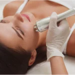 Radiofréquence médicale